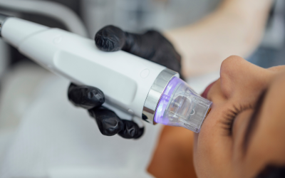 What’s the Difference between Traditional Microneedling vs. Radiofrequency Microneedling?