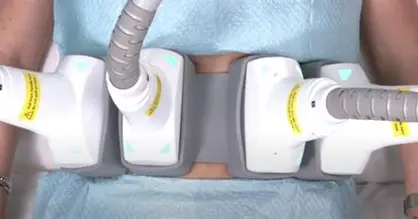 BodySculp treatment using paddles at Results Weight Loss and med spa.